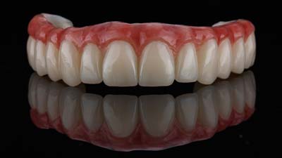 How Often Should Dentures Be Relined?